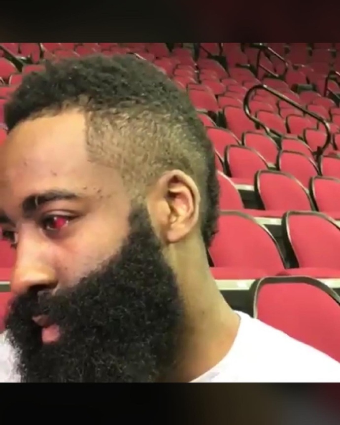 血灌瞳仁!慎点!火箭今日训练,哈登左眼特写