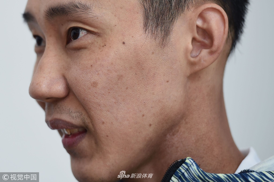 李宗伟患癌后首次出席发布会