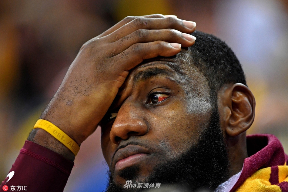 詹皇眼睛红肿吞下失利苦果