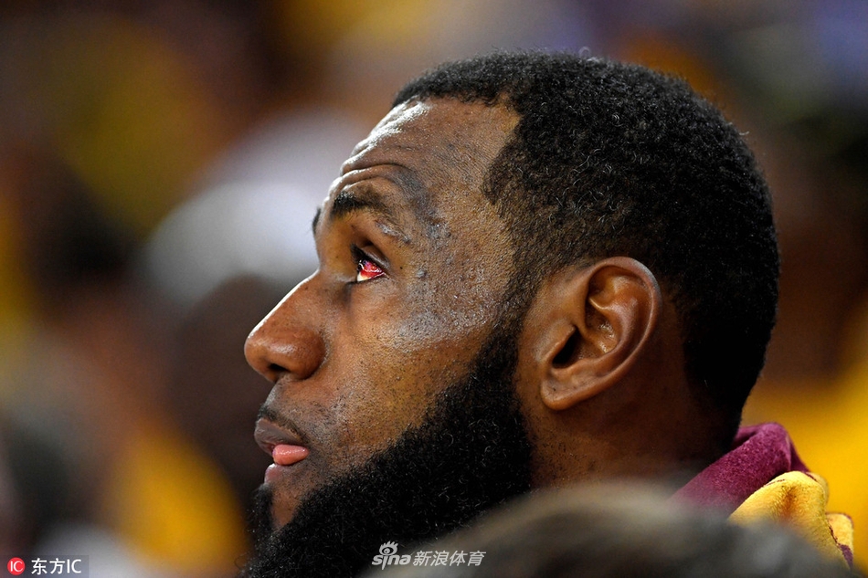 詹皇眼睛依旧红肿