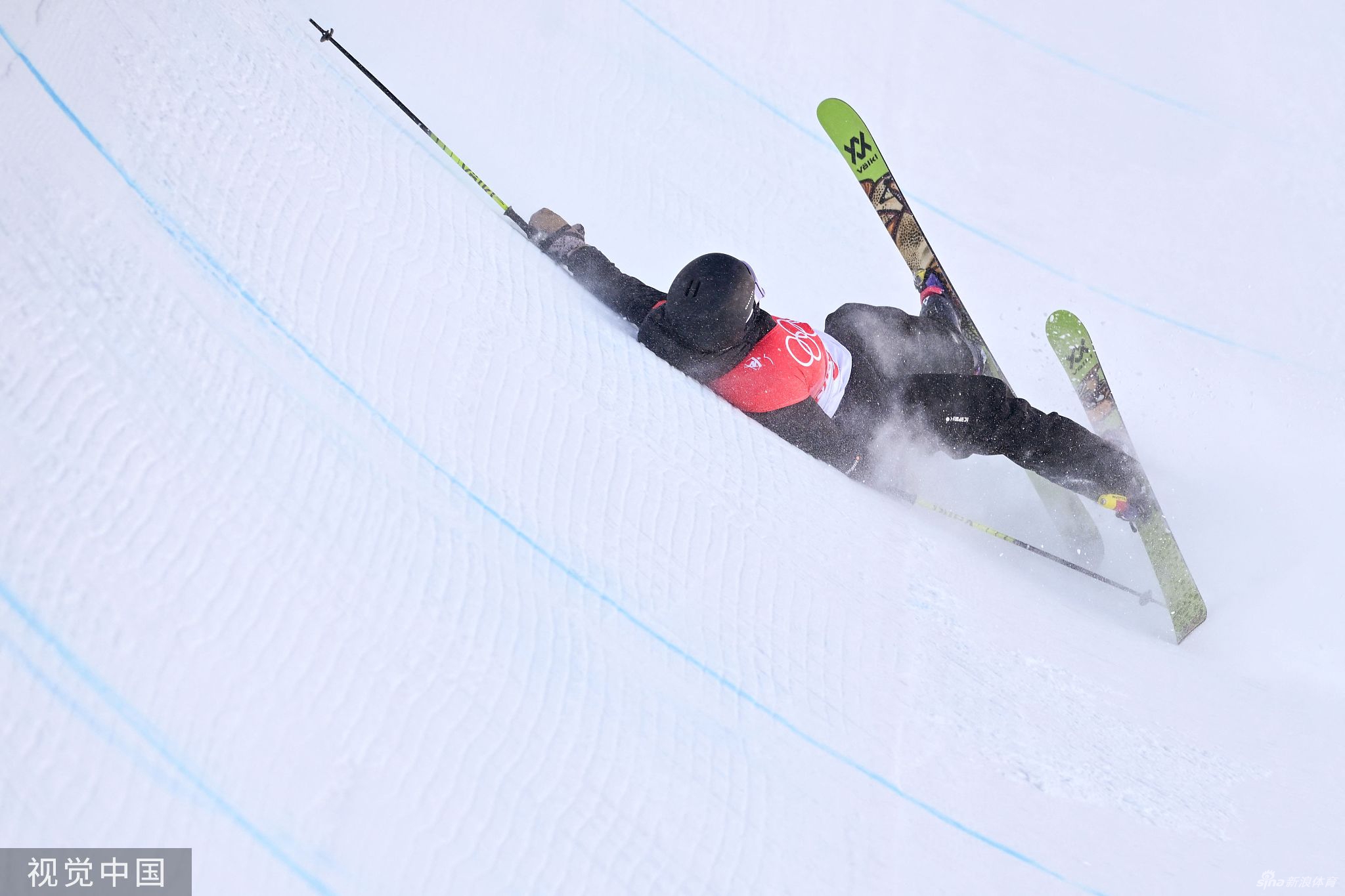 张可欣摔倒受伤倒地7分钟 医护入场紧急处理