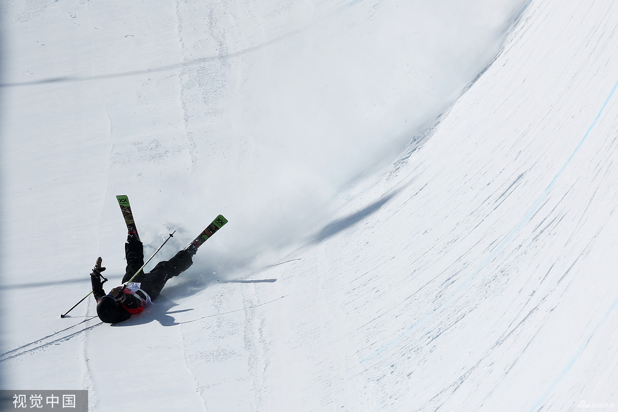 张可欣摔倒受伤倒地7分钟 医护入场紧急处理