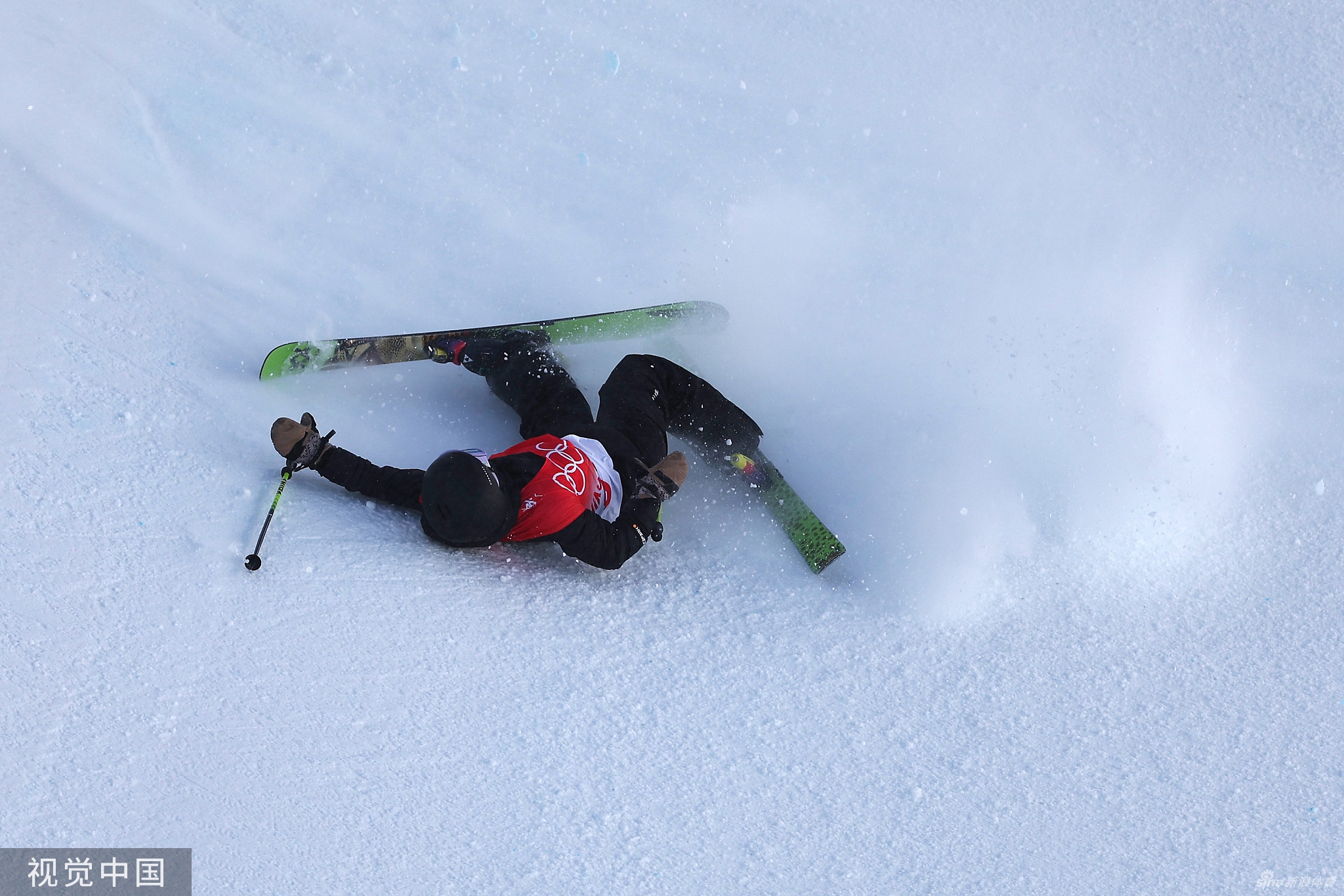 张可欣摔倒受伤倒地7分钟 医护入场紧急处理
