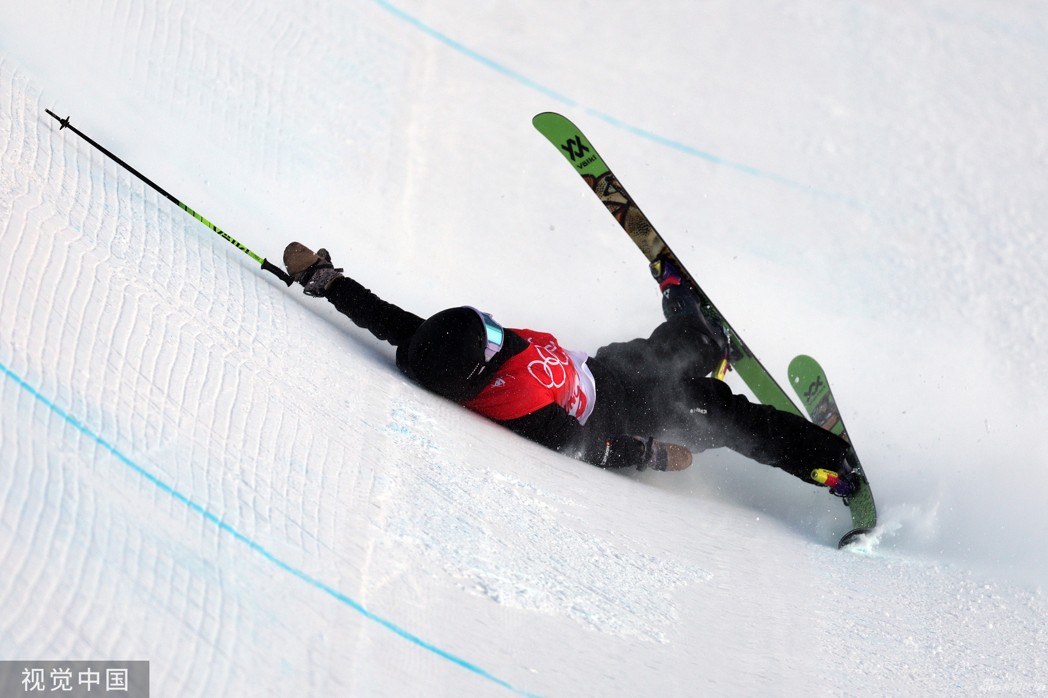 张可欣摔倒受伤倒地7分钟 医护入场紧急处理