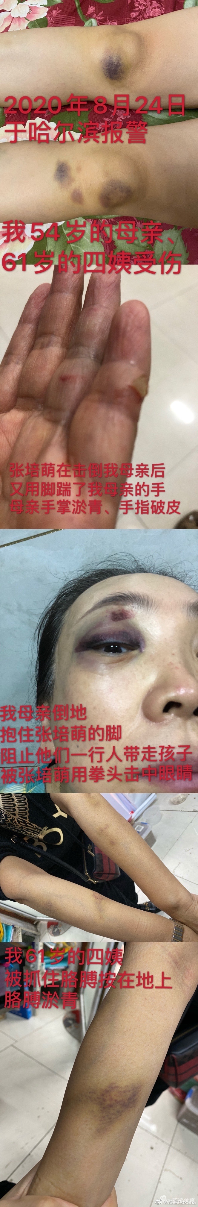 张培萌妻子控诉被出轨遭家暴提出离婚 张团队:无中生有