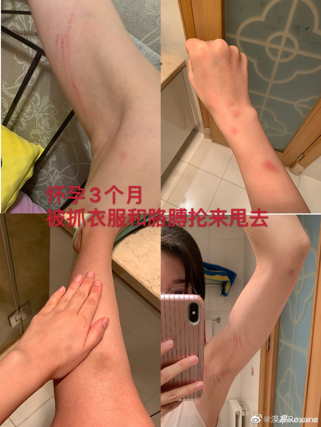 张培萌妻子控诉被出轨遭家暴提出离婚 张团队:无中生有