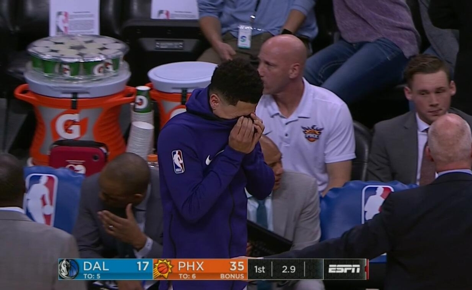 太阳后卫重伤左脚脚踝摔变形