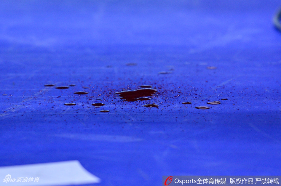 翟晓川被撞伤嘴部血溅赛场