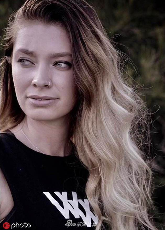 猜你喜欢 1 / 10 18岁的courtney lorking来自澳大利亚中海岸,她曾患