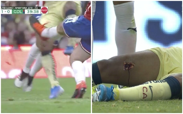 恐怖恶犯！名将大腿被扎出血洞