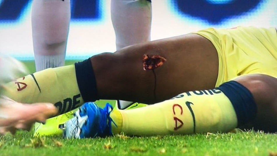 恐怖恶犯！名将大腿被扎出血洞