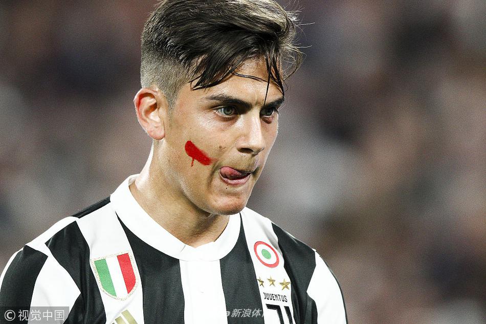 迪巴拉表情严肃