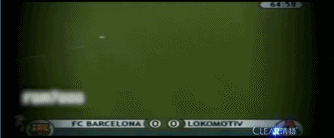 真硬！巴萨队魂一身血还笑的出 当年他场边缝针