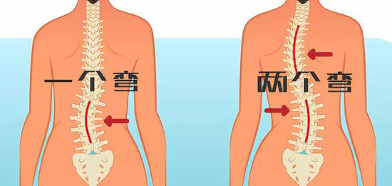 腰两侧是什么位置图片图片