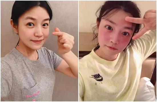 吴昕的“大象腿”变细成顶流 坚持跑步会让腿变