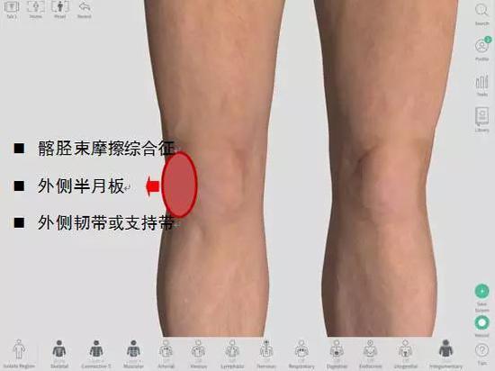 膝盖不同位置疼痛对应的可能病症 或与跑姿跑量