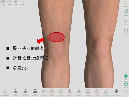 膝盖不同位置疼痛对应的可能病症 或与跑姿跑量