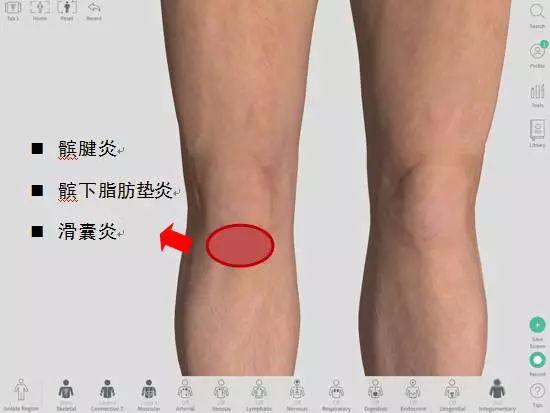 膝盖不同位置疼痛对应的可能病症 或与跑姿跑量