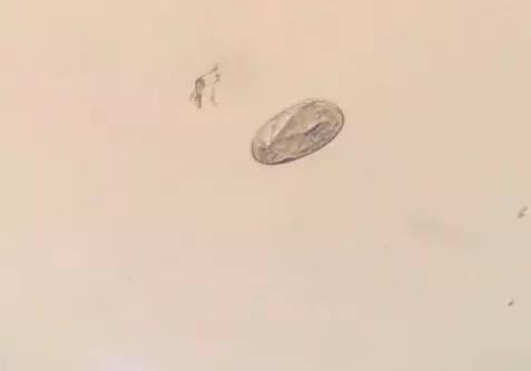 显微镜下一枚类圆线虫卵(图片来自乐驰马医疗化验室)