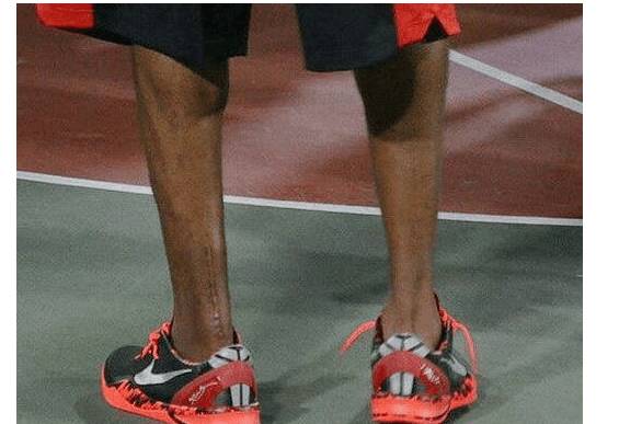 美不美全看腿拥有销魂小腿的六大球星