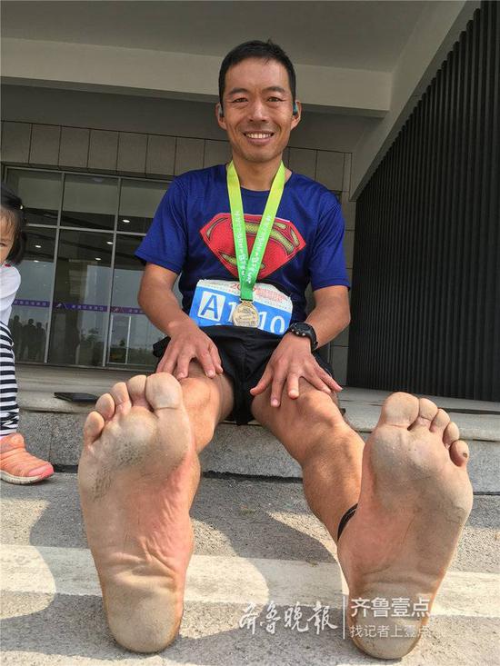 光脚的不怕穿鞋的!选手光脚跑完枣庄马拉松全马