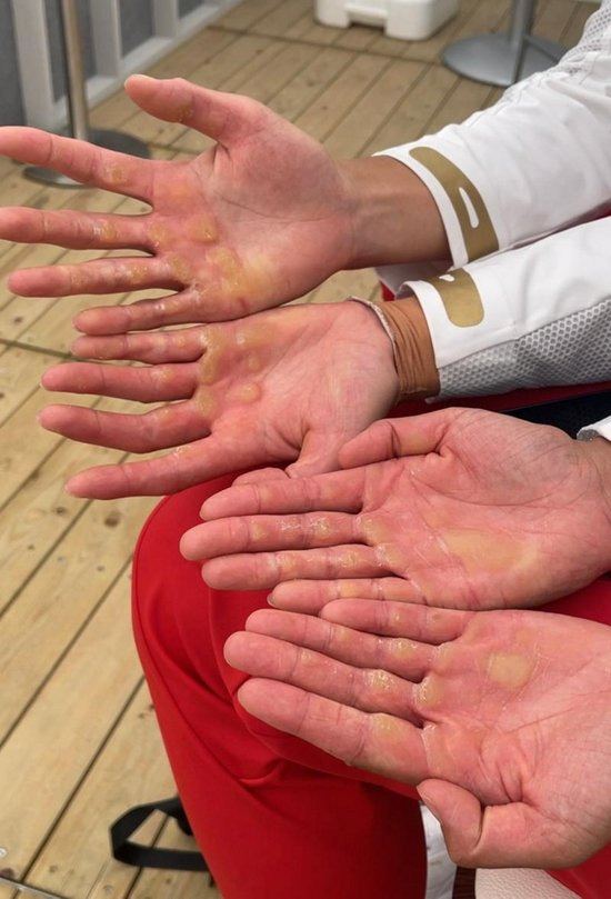 多手多脚游戏怎么玩 五个人三只脚踩两只手怎么玩