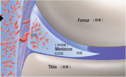 半月板损伤还能跑步吗7个问题解答你的疑问