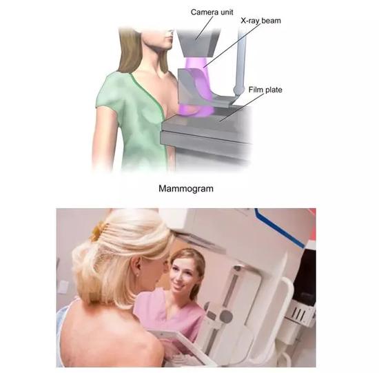 乳房X光摄影检查