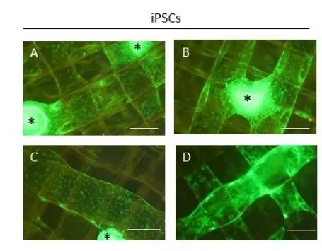 iPSCs