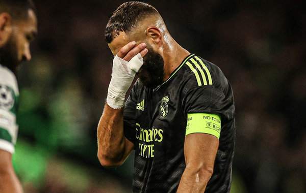 本泽马因伤无缘9月剩余比赛