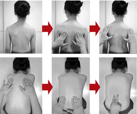 脊柱健康早预防