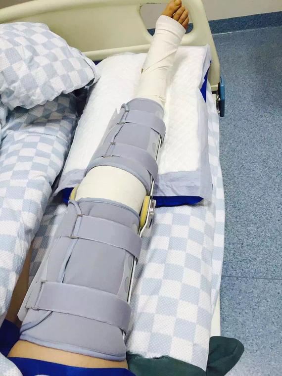 陈思明手术成功