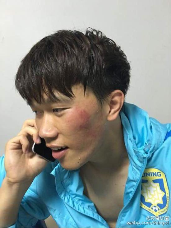 谢鹏飞被打伤(图片来源微博@笑舞紅塵 )