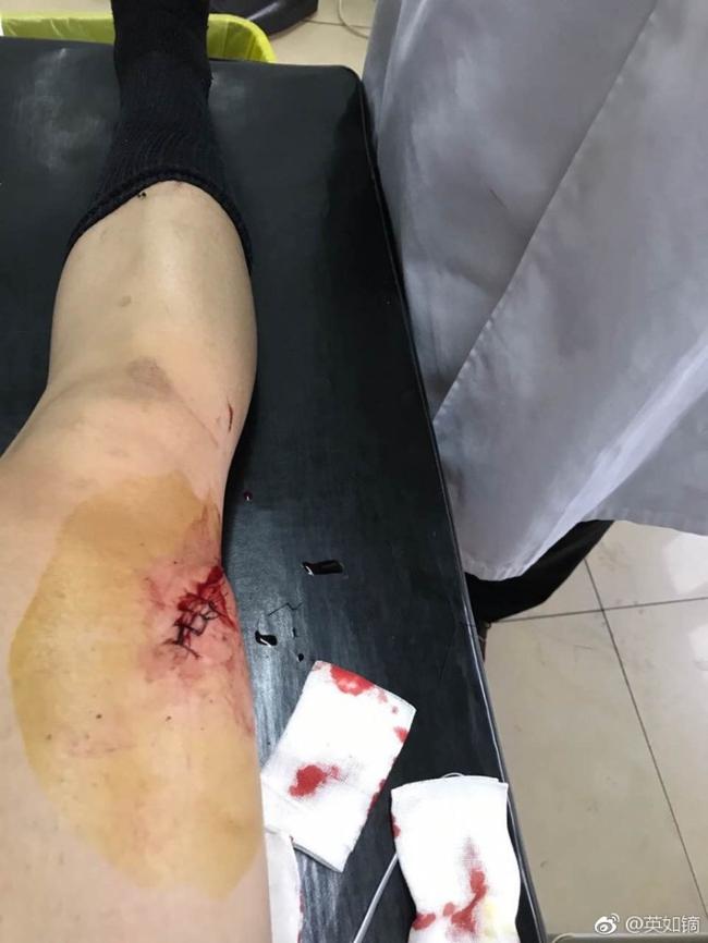 爷们北京冰球小将大腿被冰刀割伤坚持要求上场
