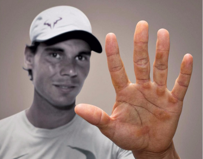 不容易!球员手部特写 费纳均有厚厚老茧(多图)