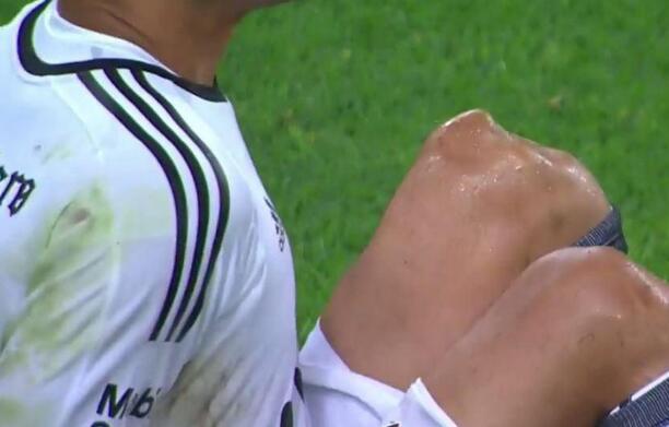 膝盖错位脱出阿根廷守门员奥斯卡-乌斯塔里遭遇罕见受伤,他在大脚开球