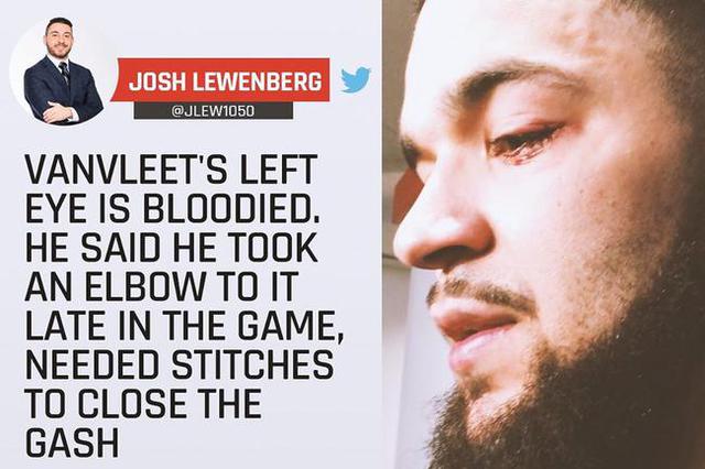 范弗里特赛后被拍到左眼受伤