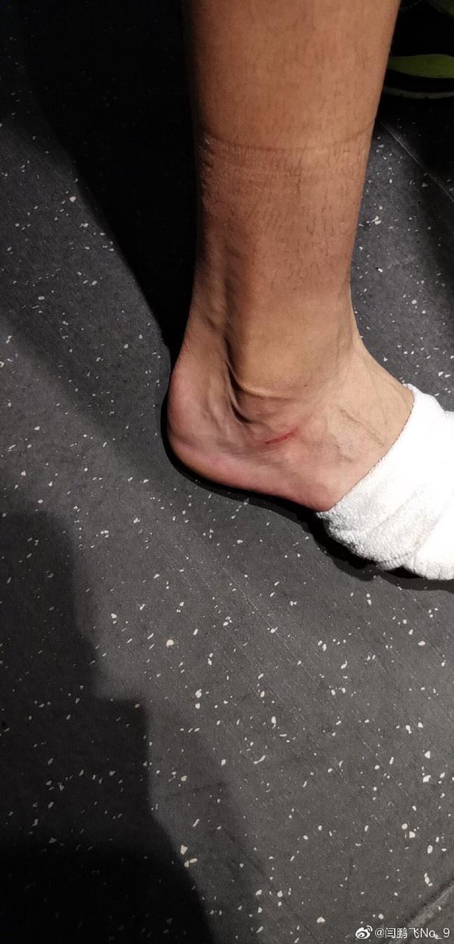 豆腐渣工程山西内线悍将踩断下水道石板摔伤