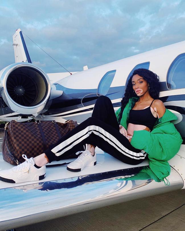 去年参加维密大秀的winnie harlow是当前最炙手可热的模特之一.