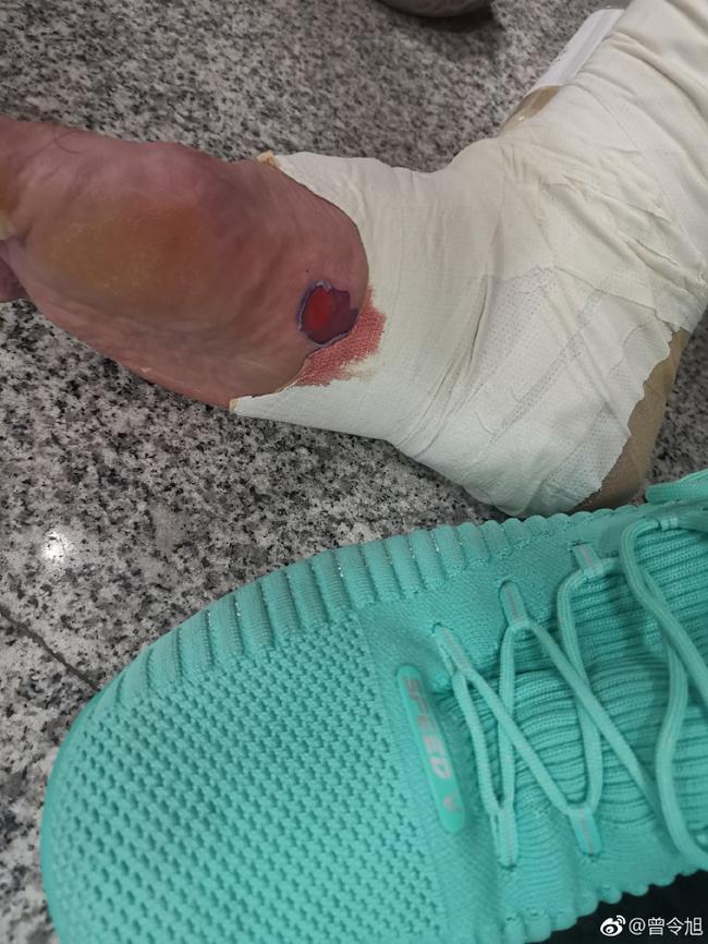 看着都疼曾令旭赛后展示脚部伤口血染红袜子