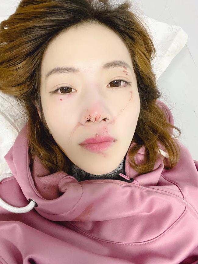 受害者面部多处创伤
