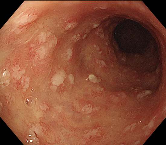 西安交大二附院提醒!滥用抗生素,小心它找上门!_新浪陕西_新浪网