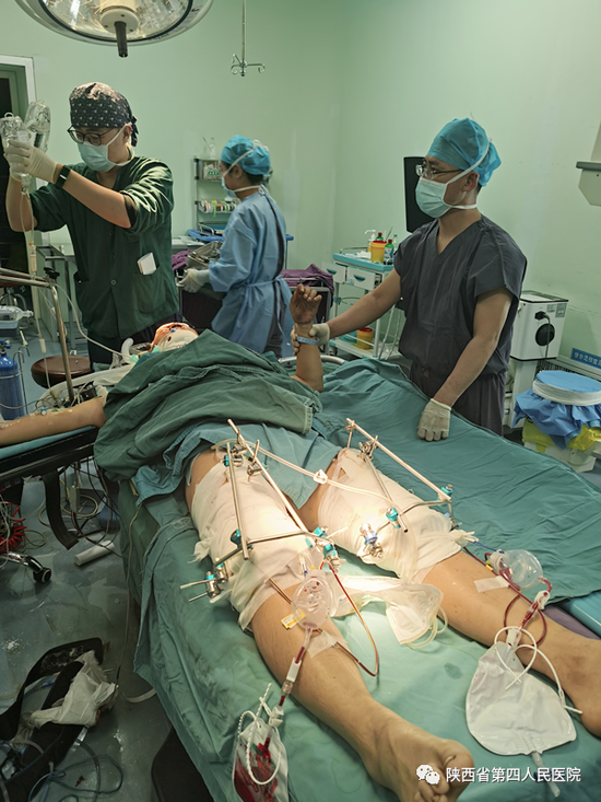 陕西省第四人民医院骨科一病区成功救治一名高空坠落患者