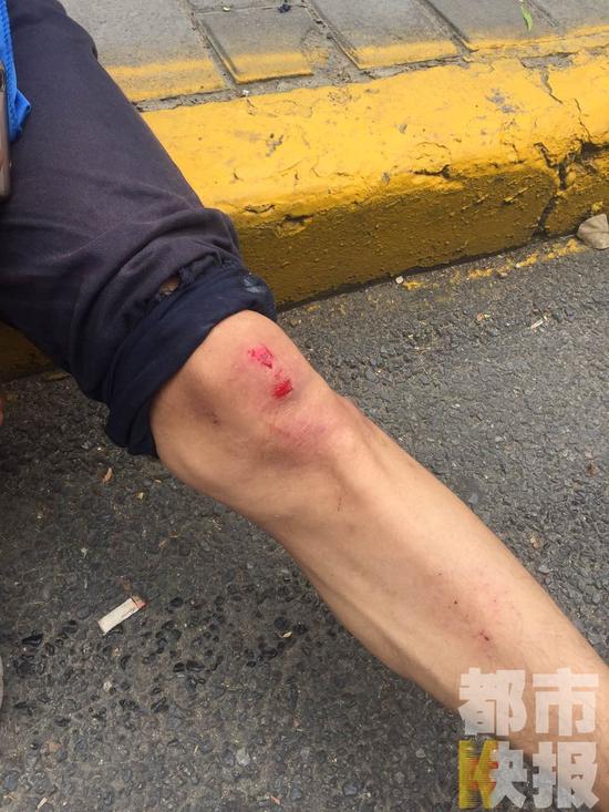 西安一公交车突然漏油抛洒路面五十米致多人摔倒受伤