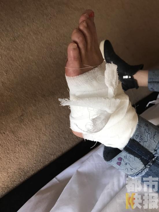 女子咸阳住店玻璃砸脚鲜血直流左脚缝了十针