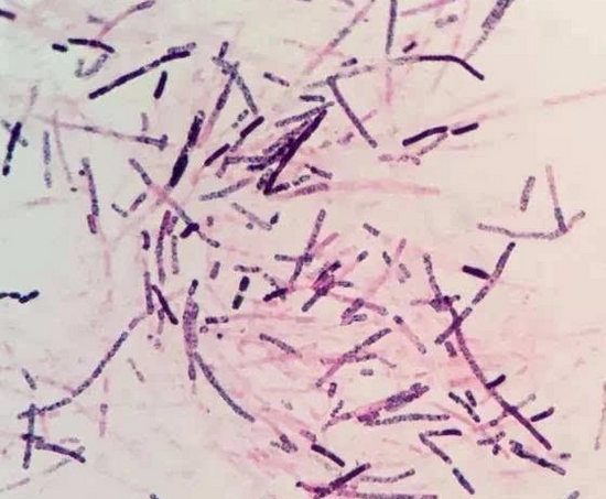 被称为眼内炎中的王者产气荚膜梭菌当真名副其实吗