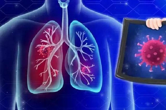关于呼吸道疾病的这些谣言别轻信！