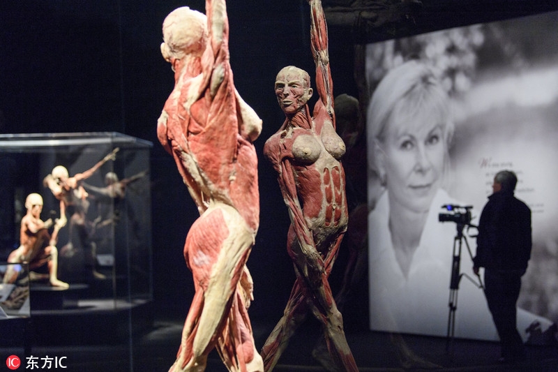 带皮肤的塑化人体标本图片