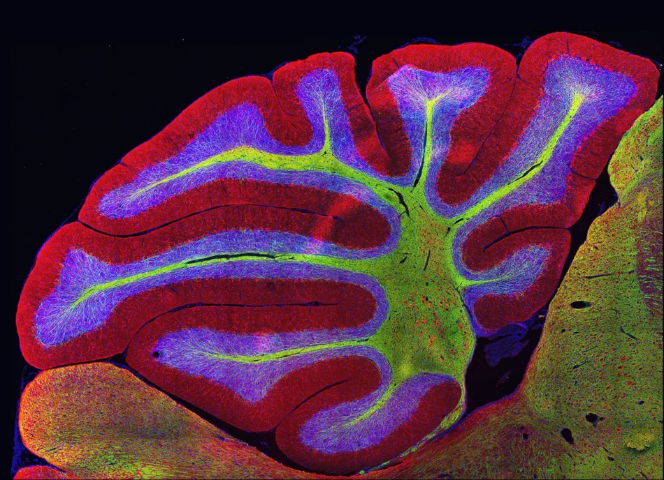 图为小鼠的小脑.脊椎动物均拥有该结构,负责控制肌肉运动.