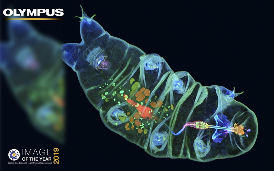 奥林巴斯显微摄影大赛:水熊透视身体和老鼠胡须结构